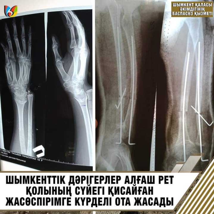 Шатырдағы жыныстық позициялар