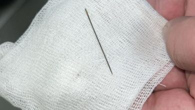 Photo of 8 АЙЛЫҚ СӘБИДІҢ ІШ ҚУЫСЫНАН ИНЕ ТАБЫЛДЫ